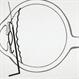 Scleral Fixated 10L Technique Cartoon